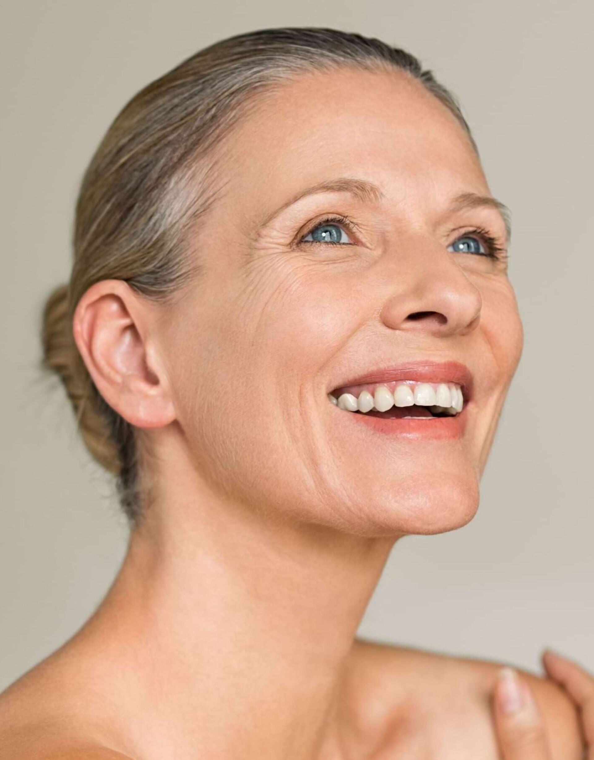 Woman with glowing skin after RF needling in Berlin.